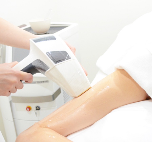 特徴とメリット｜イメージ写真